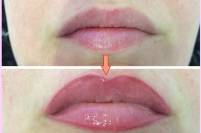 Micropigmentacion labios